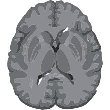Brain MRI icon